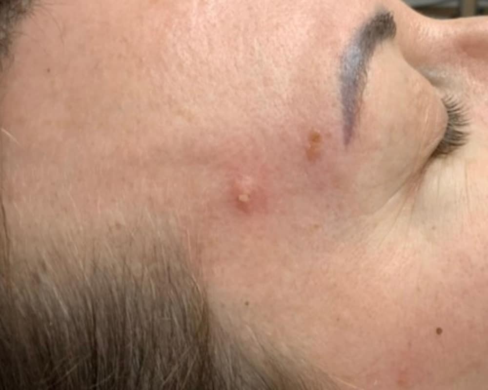 Other Potential Treatment Options 
